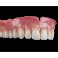 Complete denture in kampala 